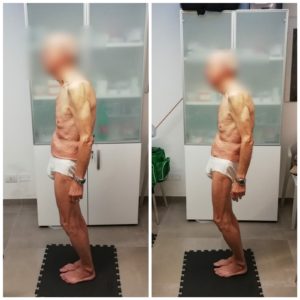 Signore anziano che migliora la sua postura